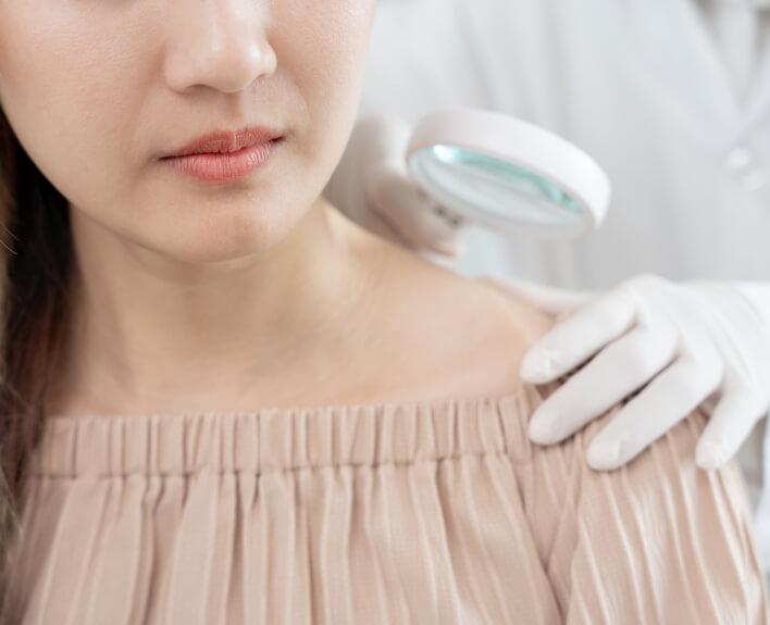 A dermatologist uses a magnifying glass on a patient's skin.