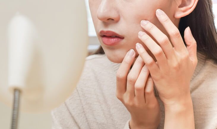 A woman examining the acne scars on her face