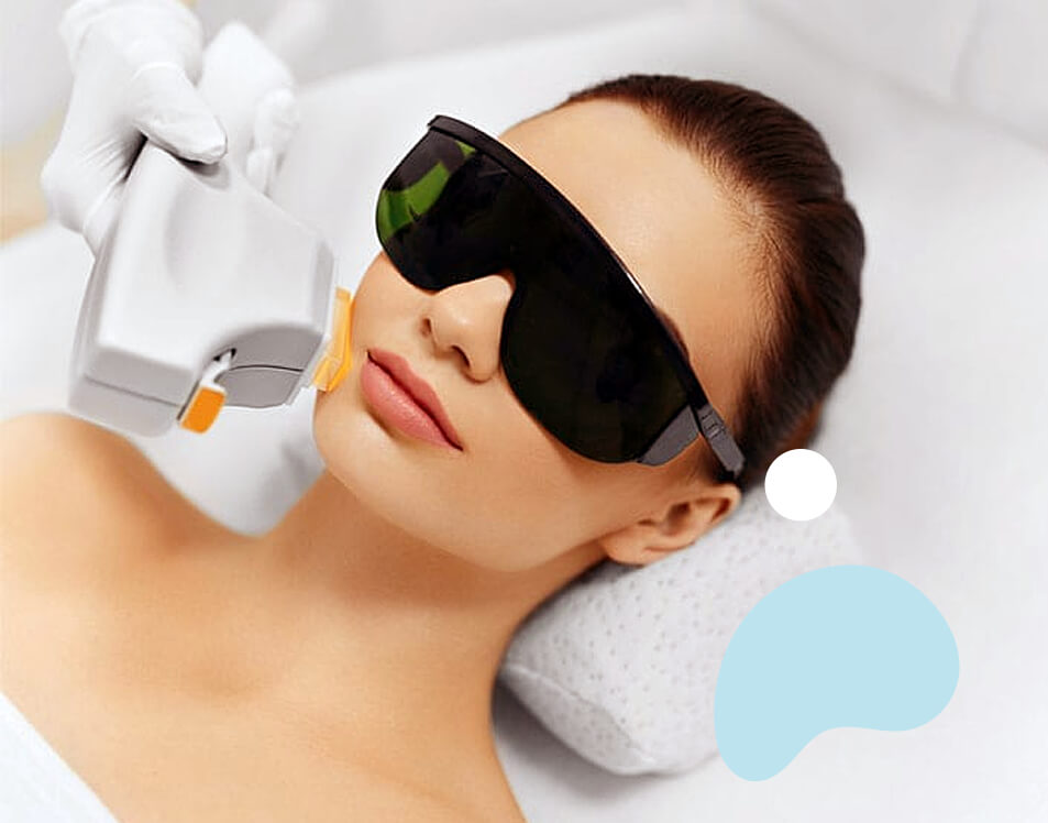 IPL Photorejuvenation